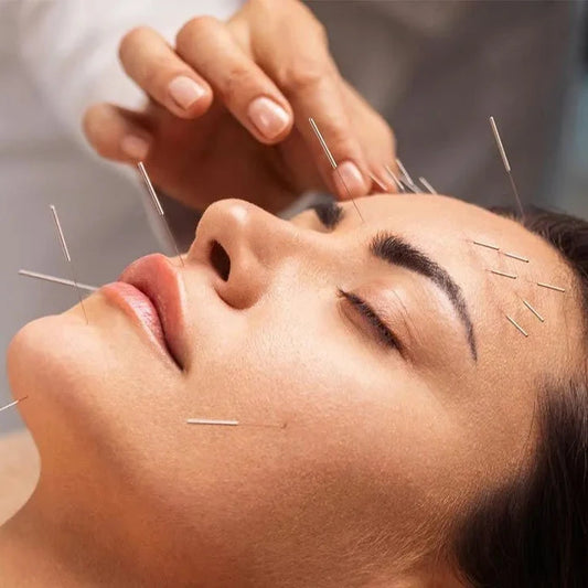 Acupuntura estética de rejuvenecimiento facial
